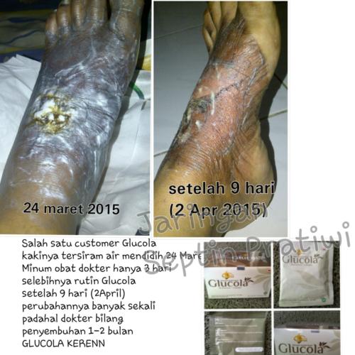 testimoni glucola 23