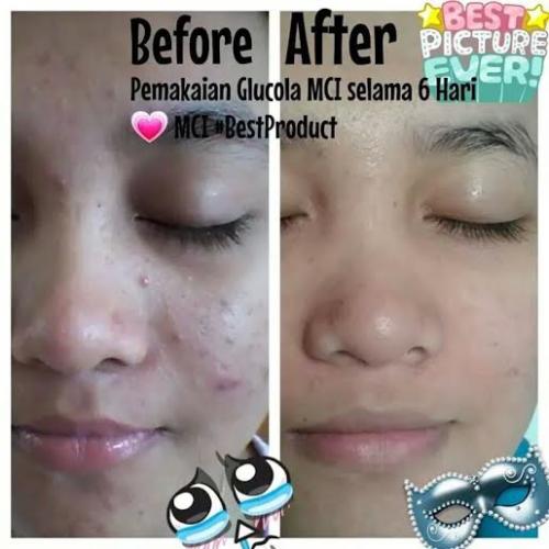 testimoni glucola 3