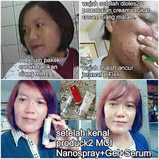 testimoni glucola serum gel 10