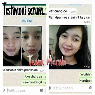 testimoni glucola serum gel 12
