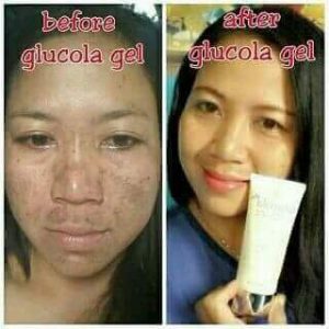 testimoni glucola serum gel 13