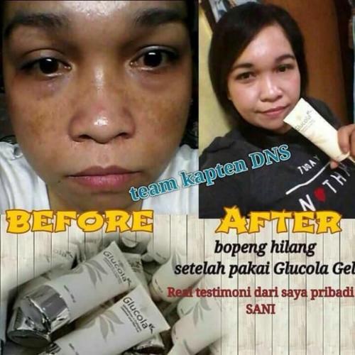 testimoni glucola serum gel 14