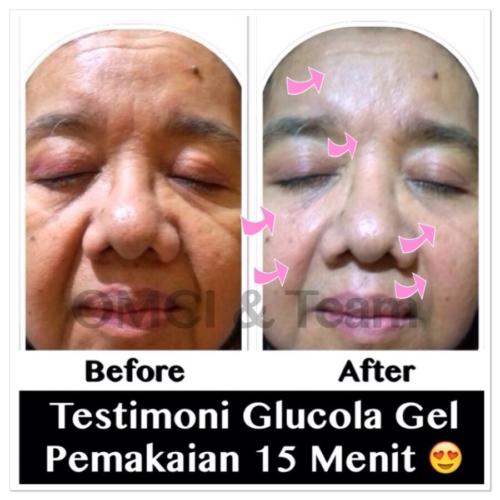 testimoni glucola serum gel 14