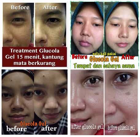 testimoni glucola serum gel 16