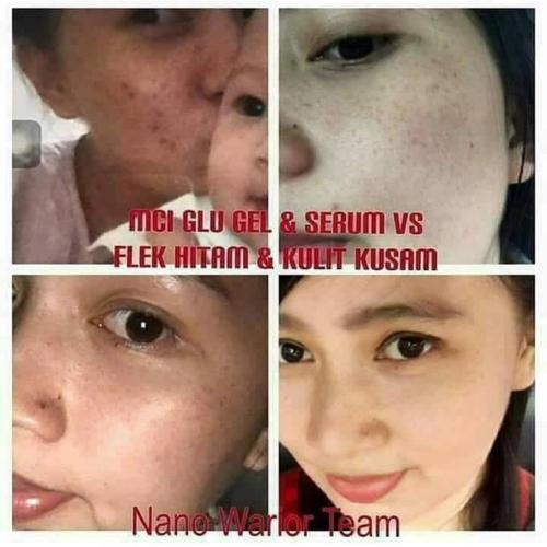 testimoni glucola serum gel 18