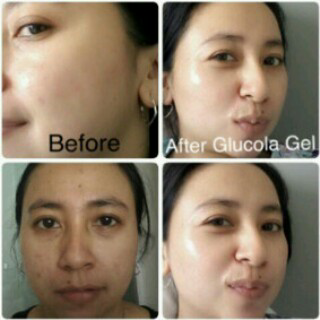 testimoni glucola serum gel 2