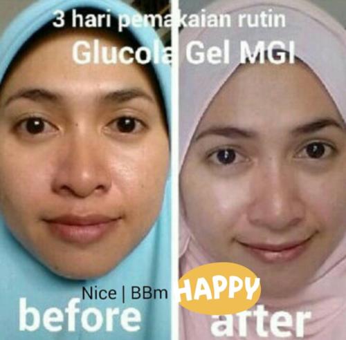 testimoni glucola serum gel 20