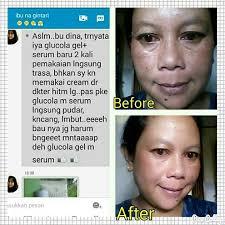 testimoni glucola serum gel 21