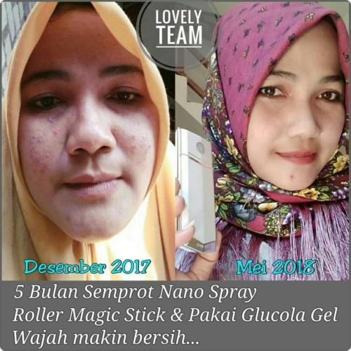 testimoni glucola serum gel 22