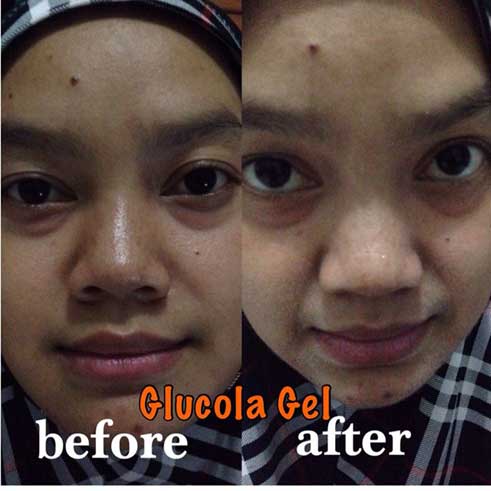testimoni glucola serum gel 23