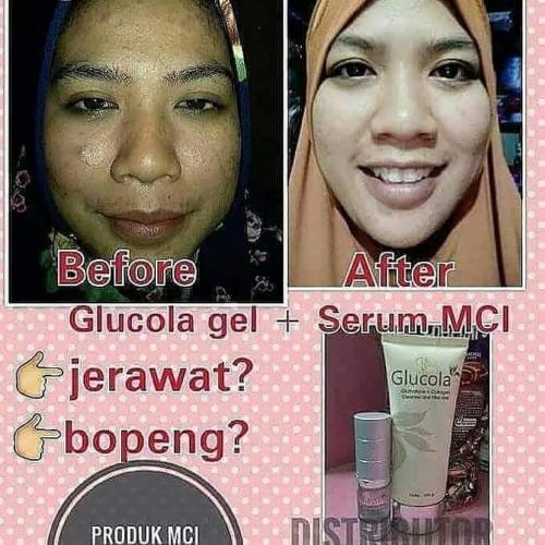 testimoni glucola serum gel 24