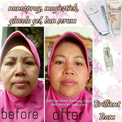 testimoni glucola serum gel 25