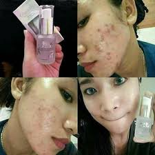 testimoni glucola serum gel 26