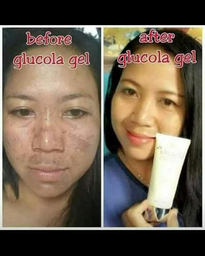 testimoni glucola serum gel 28