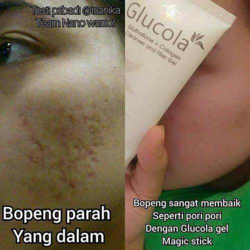 testimoni glucola serum gel 29