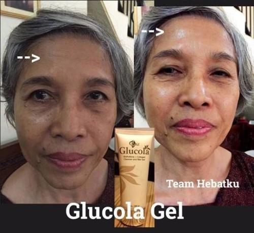 testimoni glucola serum gel 32
