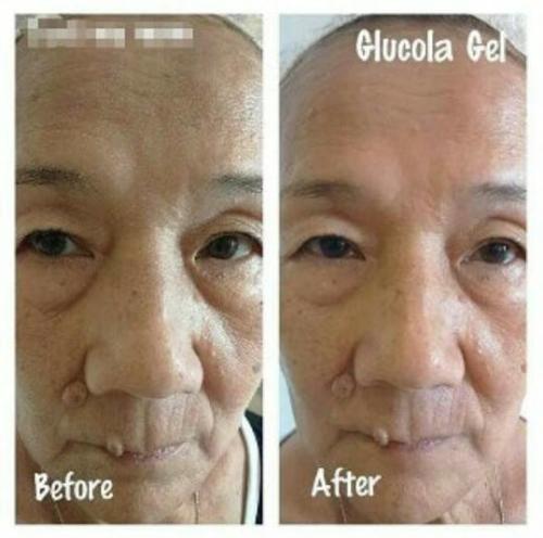 testimoni glucola serum gel 33