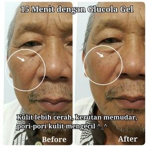 testimoni glucola serum gel 35