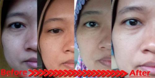 testimoni glucola serum gel 7