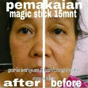 testimoni magic stick 3