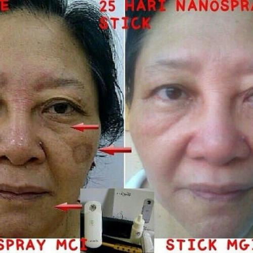 testimoni magic stick 8