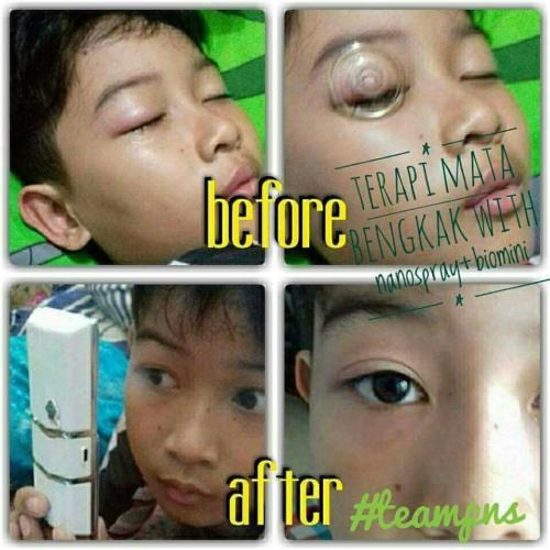 testimoni nanospray 12