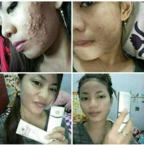 testimoni nanospray 15