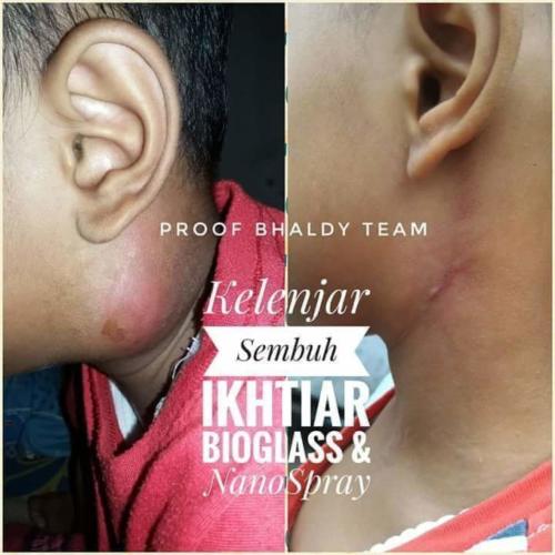 testimoni nanospray 17