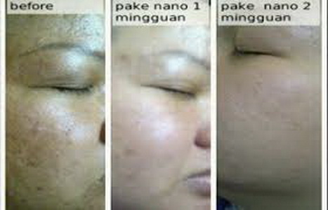 testimoni nanospray 18