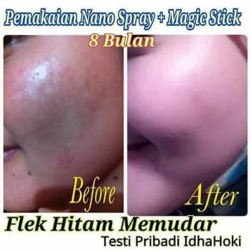 testimoni nanospray 19