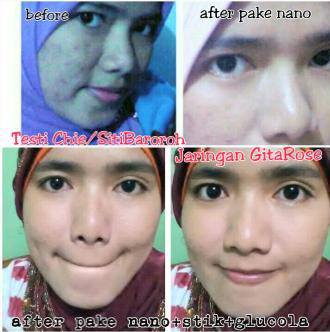 testimoni nanospray 2