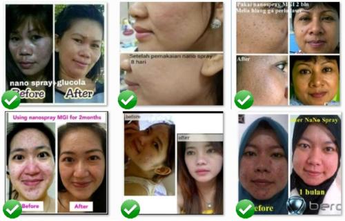 testimoni nanospray 22