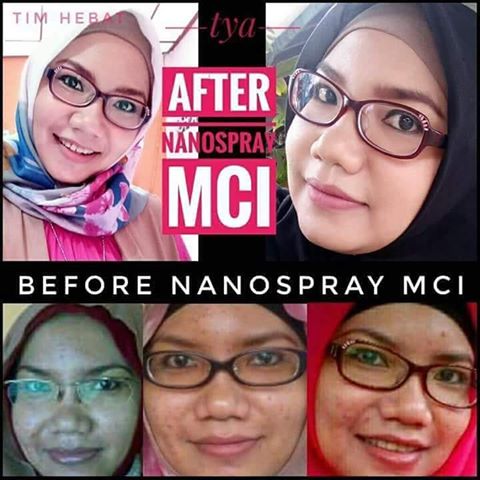 testimoni nanospray 23