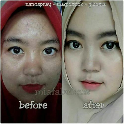 testimoni nanospray 26