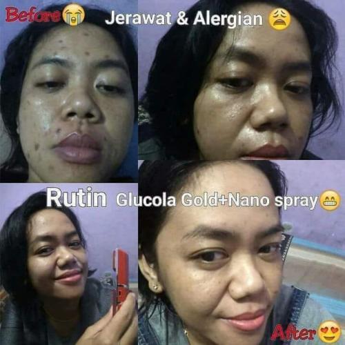 testimoni nanospray 27