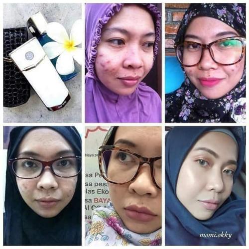 testimoni nanospray 29
