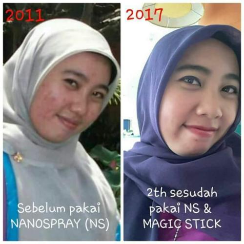 testimoni nanospray 30