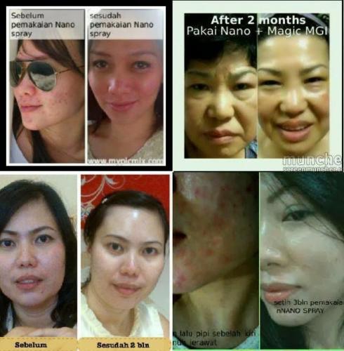 testimoni nanospray 5