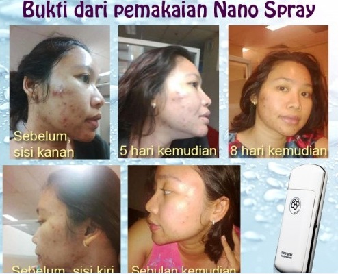 testimoni nanospray 7